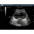 I-Price Ultrasound Scanner ye-Ultrasound Scanner